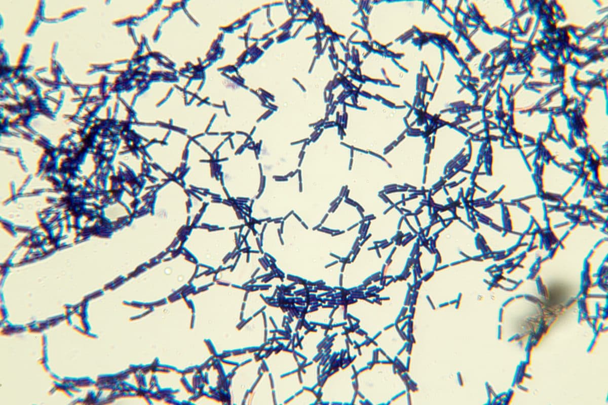 Light micrograph of stained Bacillus: dark blue rod-shaped bacterial cells and short chains against a pale background.