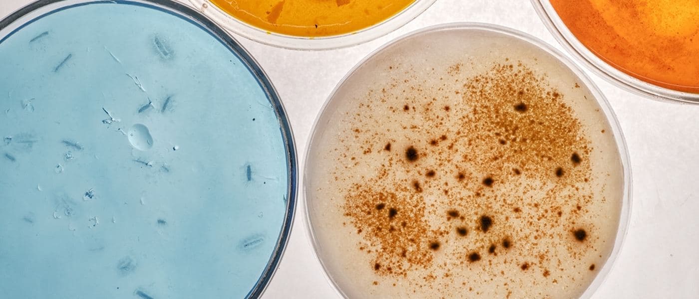 Petri dishes of cultured microbial samples on a laboratory bench.